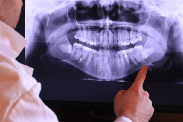 Best Dentist for Tooth Abscess  in Whitfield, FL